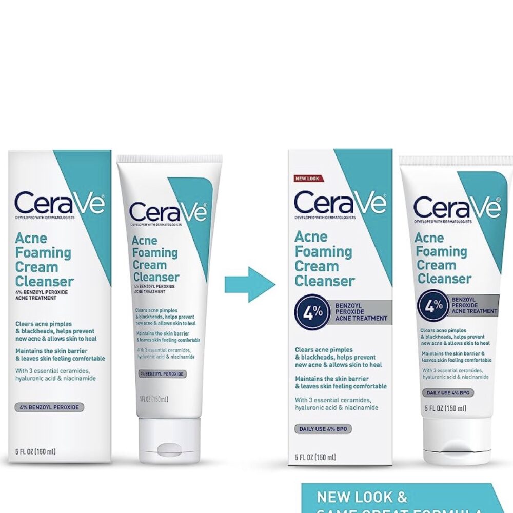 CeraVe Acne Foaming Cream Cleanser | Acne Treatment Face Wash with 4% Benzoyl Peroxide- Damaged carton